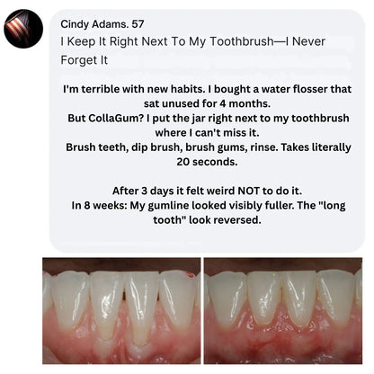 CollaGum™ Gingival Collagen Powder — Gum Recession & Tissue Rebuilding